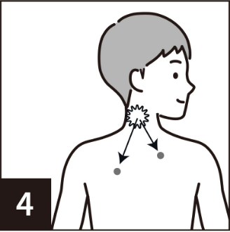 4.免疫細胞が抗原を認識 転移巣等にも効果